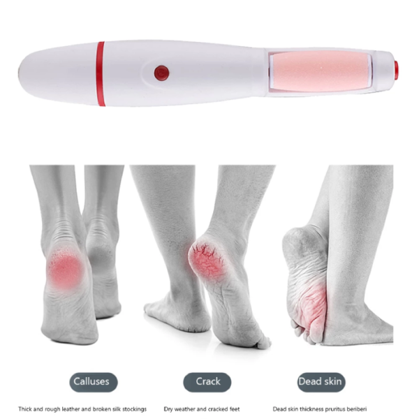 Electric Foot Sharpner | File Grinder Foot Pedicure Tool Dead Skin Callus Remover Machine